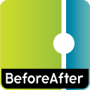 BaqFlo BeforeAfter