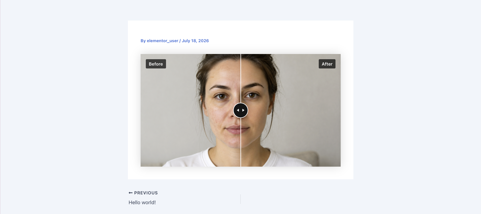 Reusable Visual Comparison editor with image controls, labels, orientation, start position, aspect ratio, and live preview.