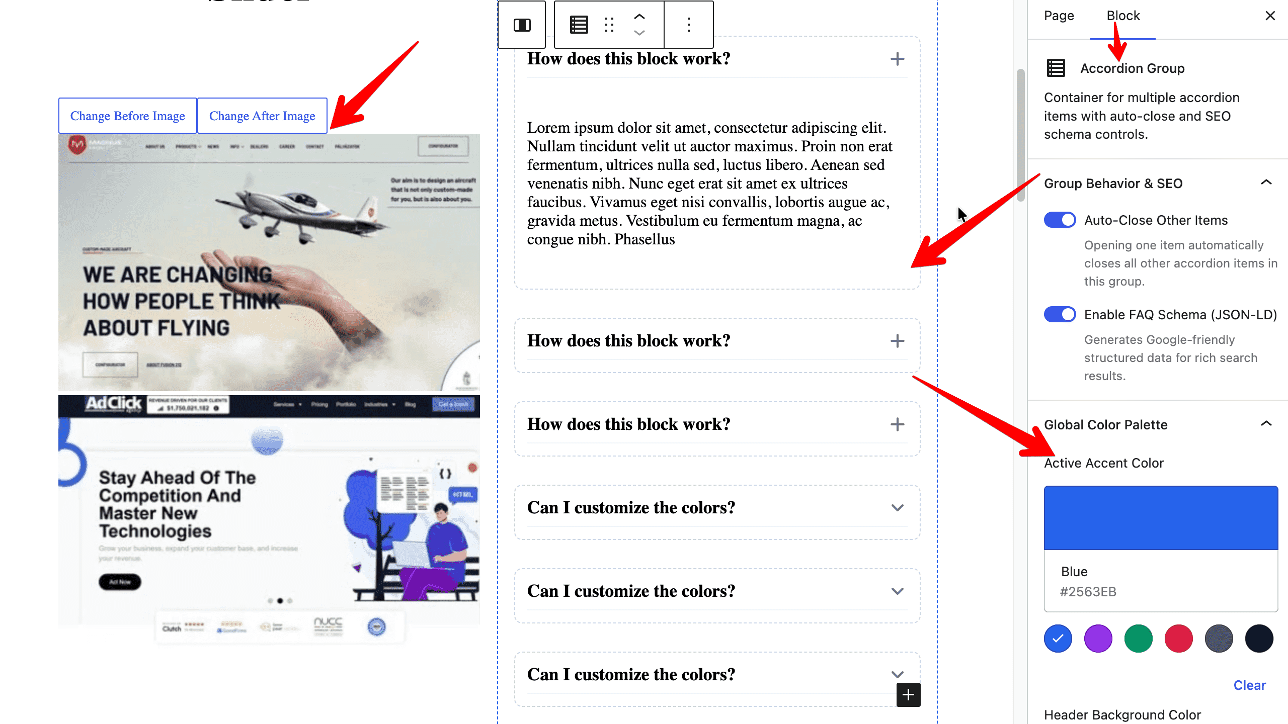 Backend Block Editor controls for the Image Comparison and Accordion blocks.